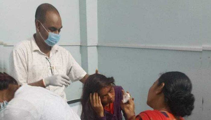 कञ्चनपुरमा फेरी बाघको आक्रमण, एक महिला घाइते